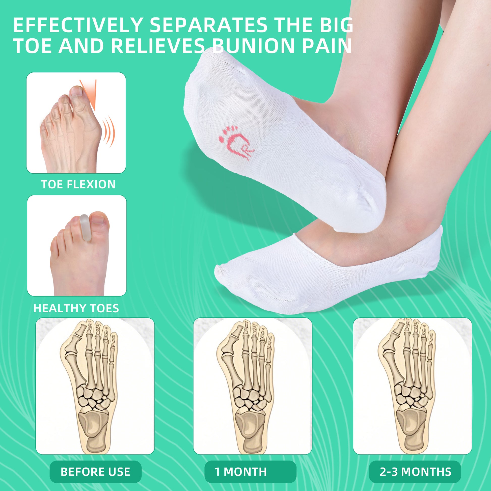 Toe separator socks for alignment